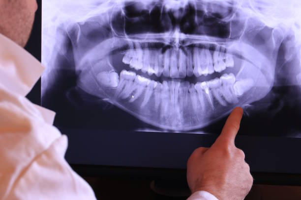 Best Tooth Infection Emergency Dentist  in Sand Ridge, NY